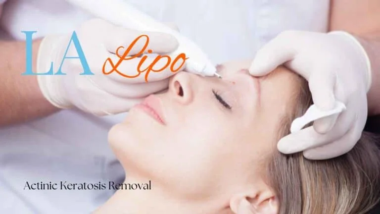 Woman receiving Actinic Keratosis Removal Treatment Stourport-on-Severn
