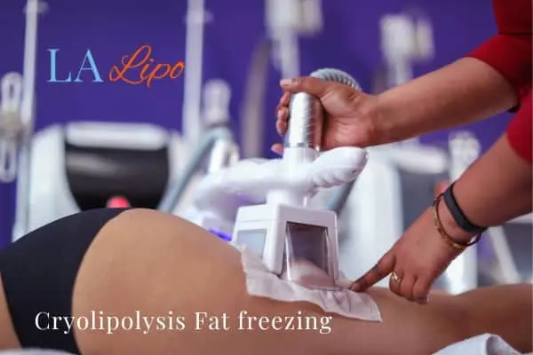 women getting fat freezing Stourport-on-Severn