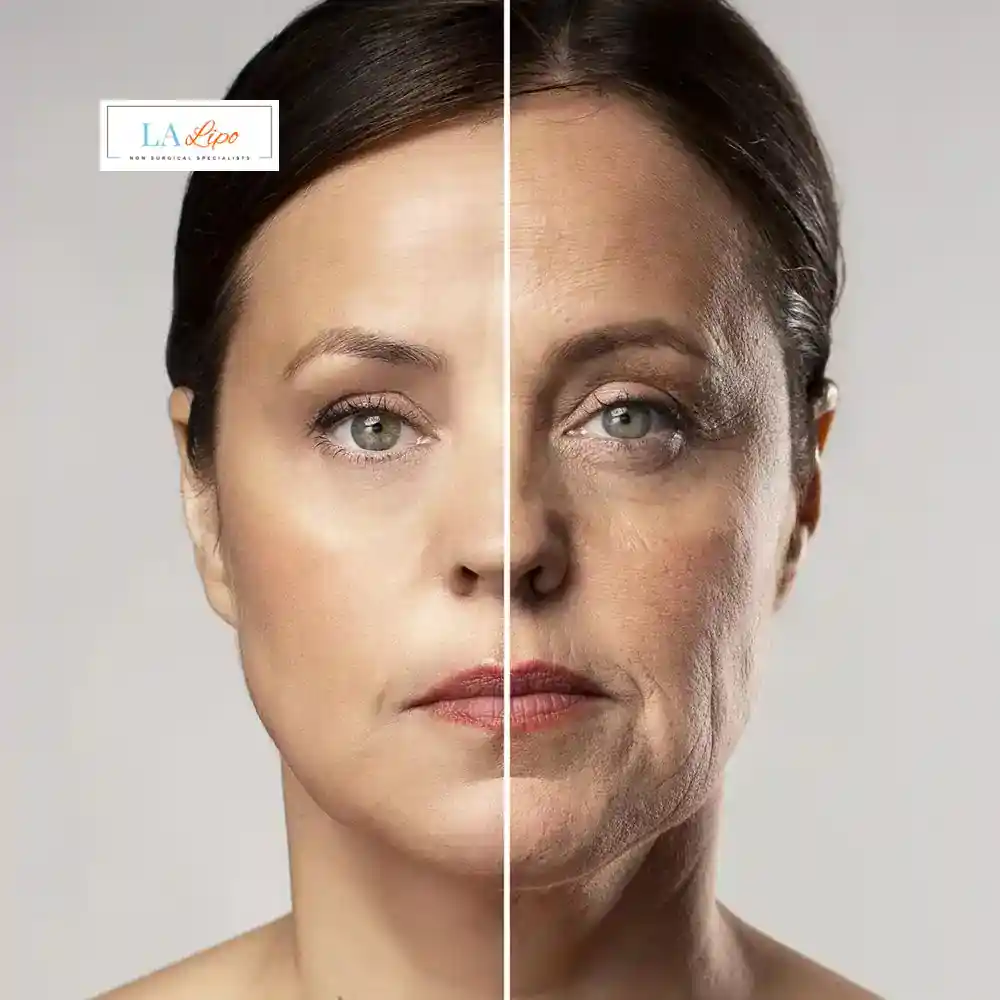 How Can You Tell If Non-Surgical Skin Tightening Is Right for You Stourport-on-Severn?