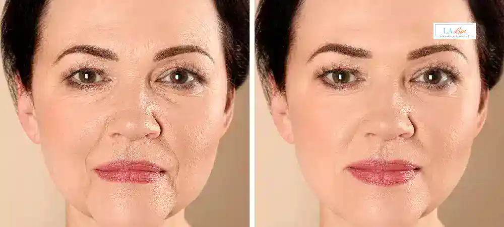 Why Aren’t My Skincare Products Making My Sagging Skin Look Firmer Stourport-on-Severn?