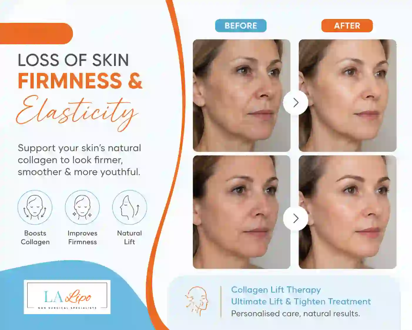 Sign #7: Loss of Skin Firmness and Elasticity Stourport-on-Severn
